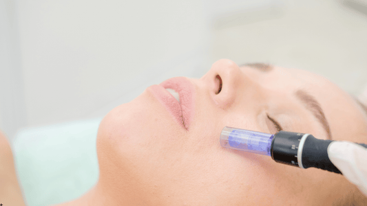 Närbild på ansikte under microneedling-behandling hemma med elektrisk dermapen mot kinden, fokus på hudstruktur och nålhuvud i kontakt med huden.