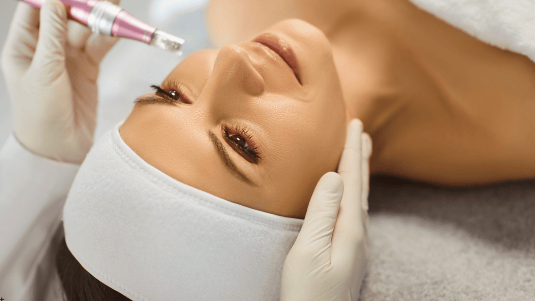 Microneedling i ansiktet med dermapen utförd av hudterapeut, visar professionell behandling och illustrerar hur många microneedling-behandlingar som krävs för synliga och långvariga resultat