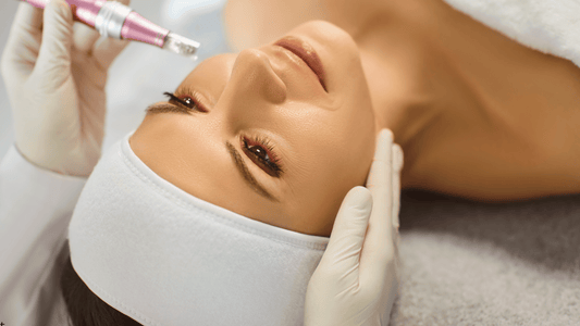 Microneedling i ansiktet med dermapen utförd av hudterapeut, visar professionell behandling och illustrerar hur många microneedling-behandlingar som krävs för synliga och långvariga resultat