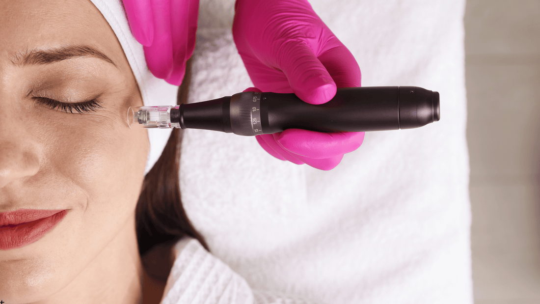 Dermapen-behandling för att minska rynkor i ansiktet