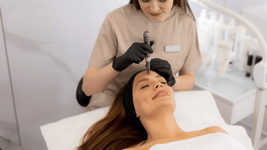 Professionell microneedling-behandling i ansiktet med dermapen – förbättrar hudens struktur, stimulerar kollagen och ger jämnare hudton.