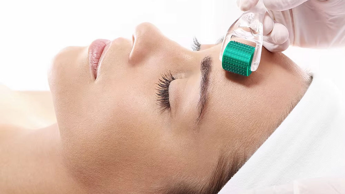 Kvinna som får microneedling-behandling i ansiktet med dermaroller utförd av hudterapeut.