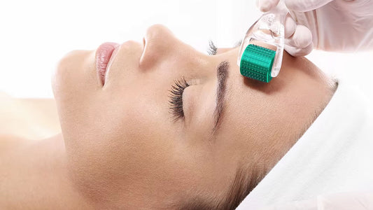 Kvinna som får microneedling-behandling i ansiktet med dermaroller utförd av hudterapeut.